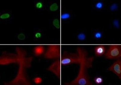 H4K5ac Antibody in Immunocytochemistry (ICC/IF)