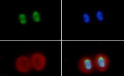 H4K16ac Antibody in Immunocytochemistry (ICC/IF)