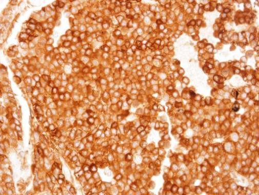 TGR5 Antibody in Immunohistochemistry (Paraffin) (IHC (P))