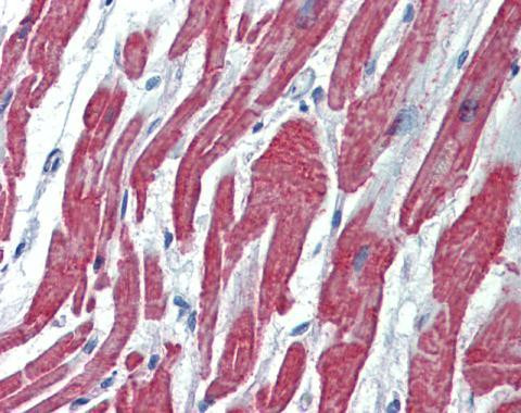 ACVRL1 Antibody in Immunohistochemistry (Paraffin) (IHC (P))