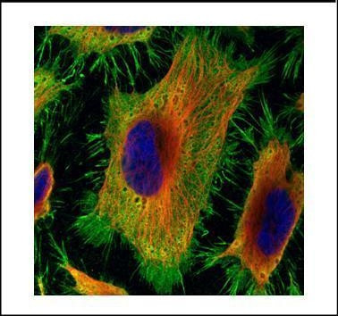 Annexin A2 Antibody in Immunocytochemistry (ICC/IF)