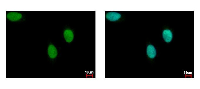 BRIP1 Antibody in Immunocytochemistry (ICC/IF)