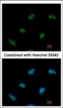 RAD9 Antibody in Immunocytochemistry (ICC/IF)