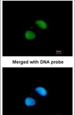 XRCC4 Antibody in Immunocytochemistry (ICC/IF)
