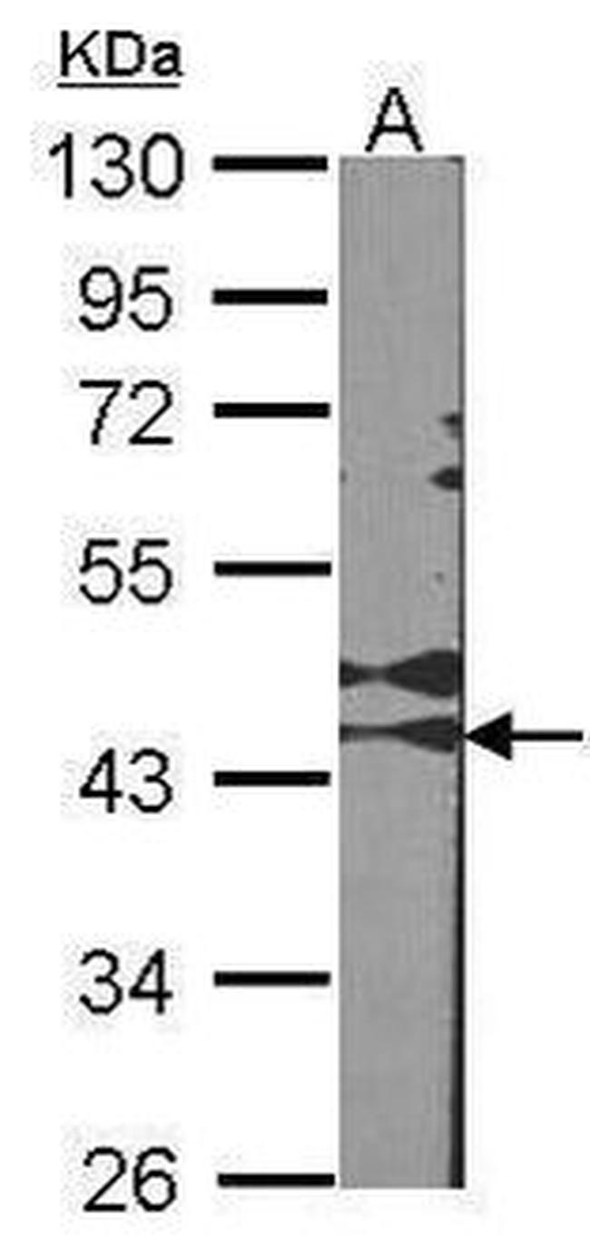 RAD51C Antibody in Western Blot (WB)