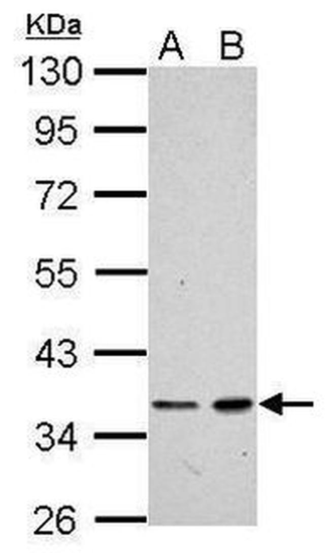 XRCC4 Antibody in Western Blot (WB)