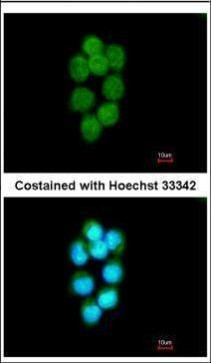 TDP1 Antibody in Immunocytochemistry (ICC/IF)