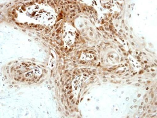 Artemis Antibody in Immunohistochemistry (Paraffin) (IHC (P))