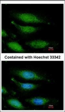 FANCG Antibody in Immunocytochemistry (ICC/IF)