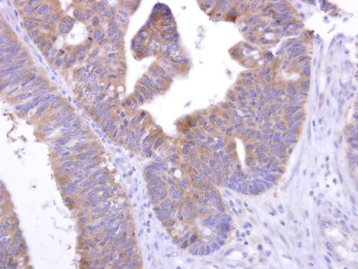 GPR82 Antibody in Immunohistochemistry (Paraffin) (IHC (P))