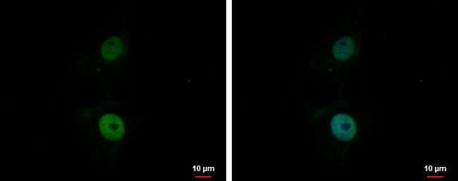 BCL7A Antibody in Immunocytochemistry (ICC/IF)