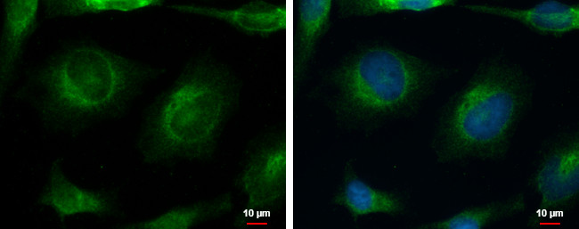 Calcium Channel beta-4 Antibody in Immunocytochemistry (ICC/IF)