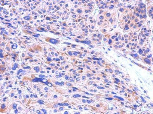 CBR1 Antibody in Immunohistochemistry (Paraffin) (IHC (P))