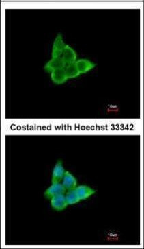 CIS Antibody in Immunocytochemistry (ICC/IF)