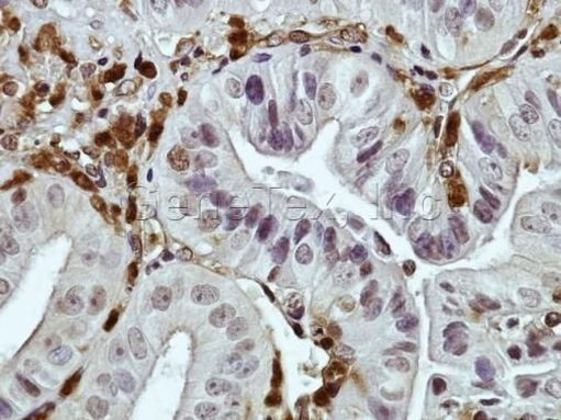 DAB2 Antibody in Immunohistochemistry (IHC)