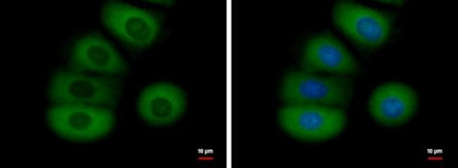 FGFR1 Antibody in Immunocytochemistry (ICC/IF)