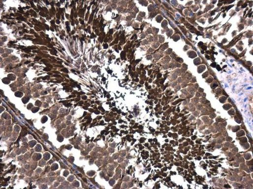 GCN5 Antibody in Immunohistochemistry (Paraffin) (IHC (P))