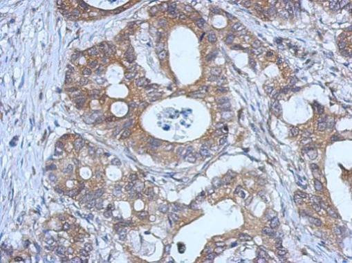 GPX2 Antibody in Immunohistochemistry (Paraffin) (IHC (P))