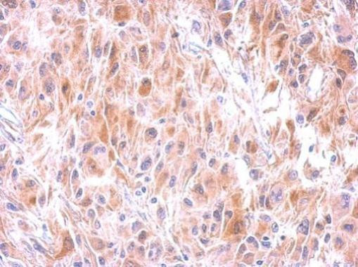 GSTM1 Antibody in Immunohistochemistry (Paraffin) (IHC (P))