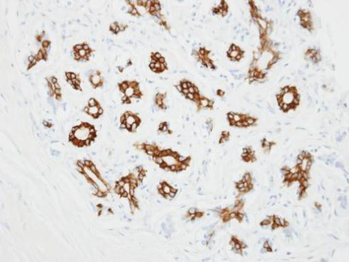 alpha-2c Adrenergic Receptor Antibody in Immunohistochemistry (Paraffin) (IHC (P))