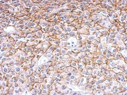 Endothelin B Receptor Antibody in Immunohistochemistry (Paraffin) (IHC (P))