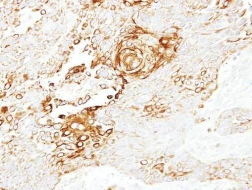 LGR4 Antibody in Immunohistochemistry (Paraffin) (IHC (P))