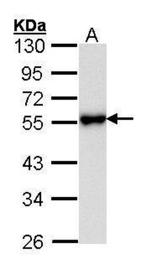 KISS1R Antibody in Western Blot (WB)