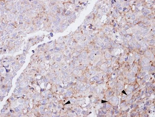 Glucagon Receptor Antibody in Immunohistochemistry (Paraffin) (IHC (P))