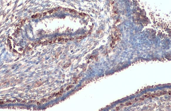 CXCR1 Antibody in Immunohistochemistry (Paraffin) (IHC (P))