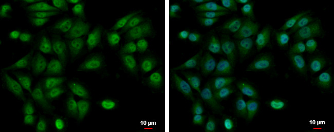 UBE2A Antibody in Immunocytochemistry (ICC/IF)