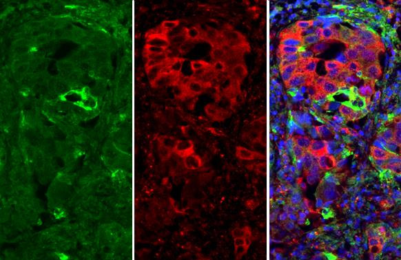 ICAM-1 Antibody in Immunohistochemistry (Paraffin) (IHC (P))