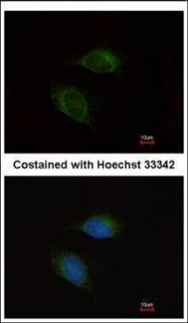 MMP9 Antibody in Immunocytochemistry (ICC/IF)