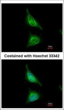 Aladin Antibody in Immunocytochemistry (ICC/IF)