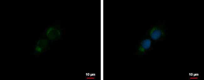 IGF1 Antibody in Immunocytochemistry (ICC/IF)
