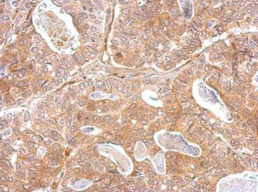 Kallikrein 2 Antibody in Immunohistochemistry (Paraffin) (IHC (P))
