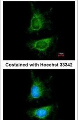 MDM2 Antibody in Immunocytochemistry (ICC/IF)