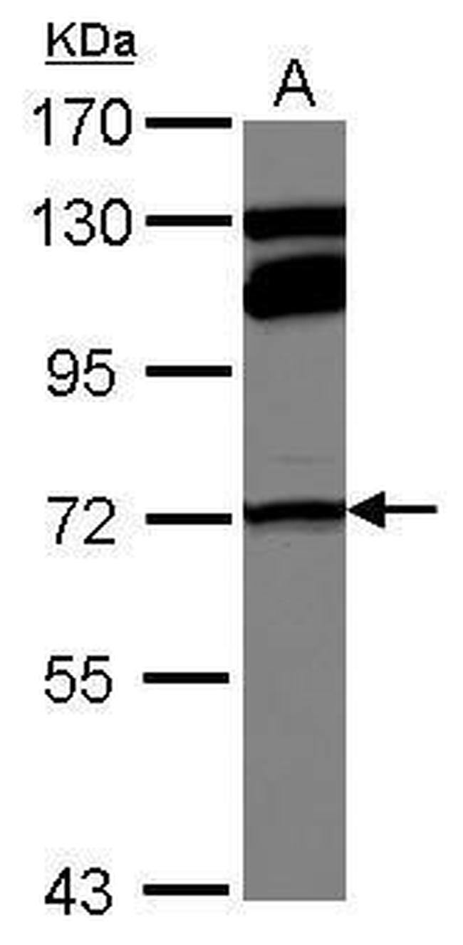 MTHFR Antibody in Western Blot (WB)