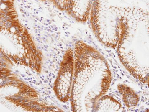 MVP Antibody in Immunohistochemistry (Paraffin) (IHC (P))