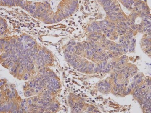PAI1 Antibody in Immunohistochemistry (Paraffin) (IHC (P))