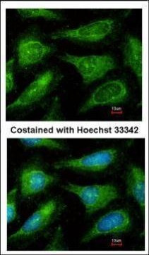 YES1 Antibody in Immunocytochemistry (ICC/IF)