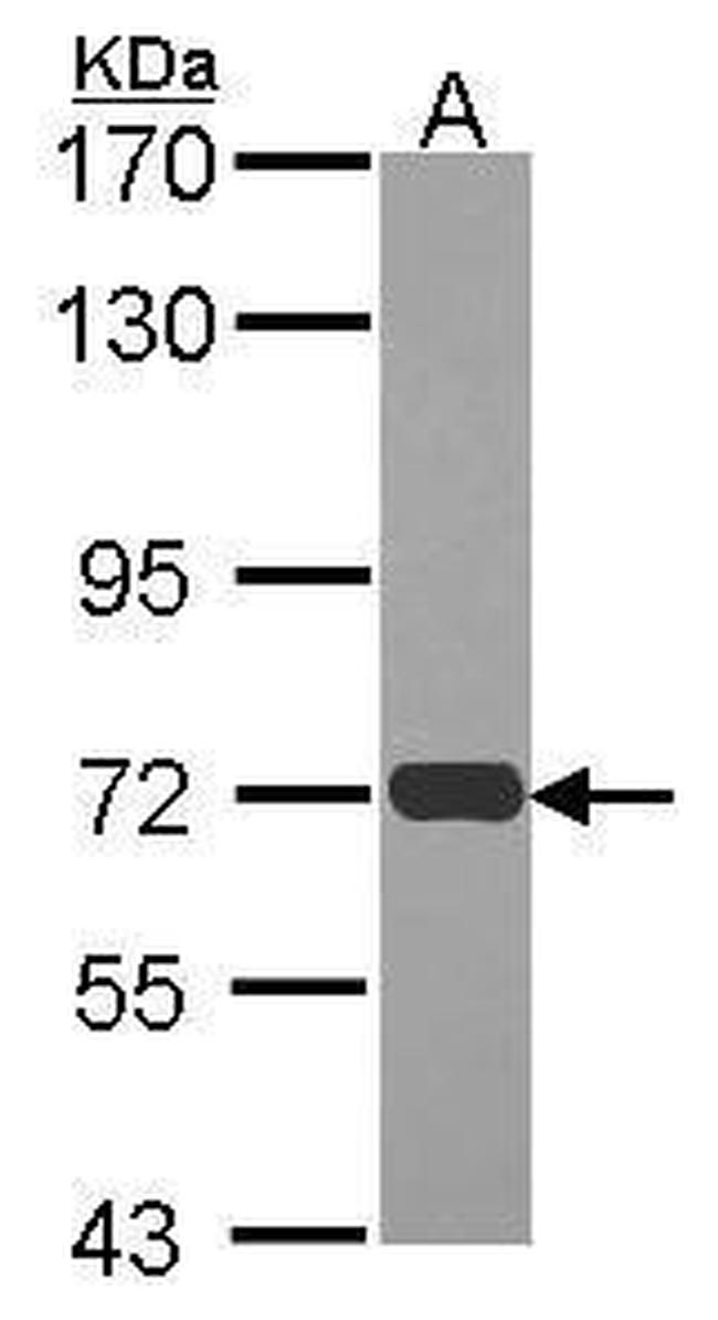 RAD54L Antibody in Western Blot (WB)