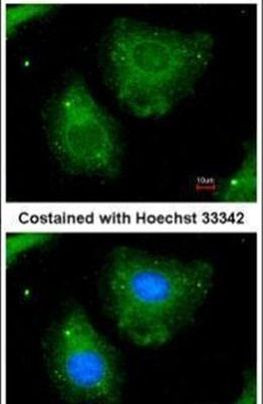 K-Ras Antibody in Immunocytochemistry (ICC/IF)