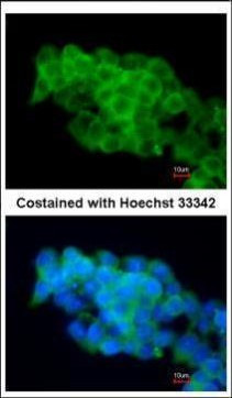 CD36 Antibody in Immunocytochemistry (ICC/IF)