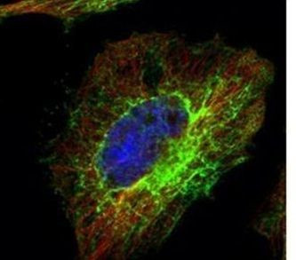 MDM2 Antibody in Immunocytochemistry (ICC/IF)