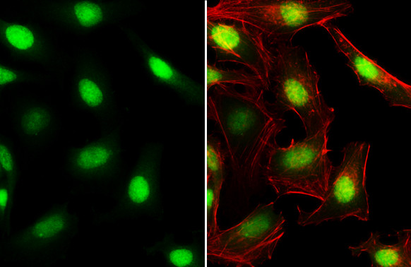 C/EBP beta Antibody in Immunocytochemistry (ICC/IF)
