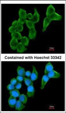Cystatin S Antibody in Immunocytochemistry (ICC/IF)