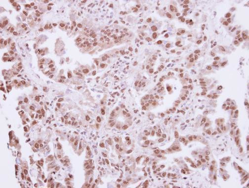 PAX7 Antibody in Immunohistochemistry (Paraffin) (IHC (P))