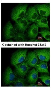 MMP12 Antibody in Immunocytochemistry (ICC/IF)
