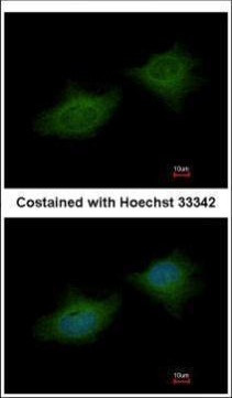 MMP3 Antibody in Immunocytochemistry (ICC/IF)