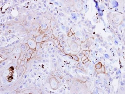 GPR83 Antibody in Immunohistochemistry (Paraffin) (IHC (P))